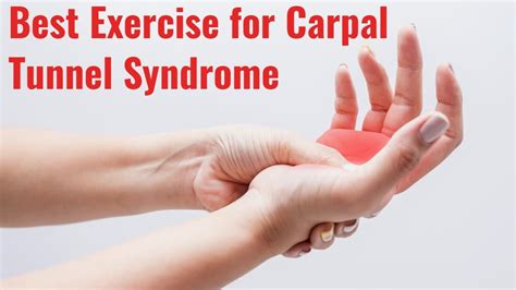 Best Exercises for Carpal Tunnel Syndrome | Milton Chiropractic Clinic