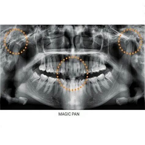 OPG X-Ray Machine, For Radiography, 10 Ma at Rs 1000000 in Kolkata | ID: 2374108312