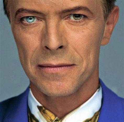 David Bowie and his heterochromia (eyes of different colours) | David ...