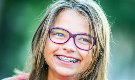 How do I know if my child needs braces? – Smile Dental Partners