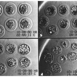 (PDF) Zona pellucida escape by hamster blastocysts in vitro is delayed and morphologically ...