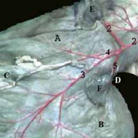 A photograph showing accessory spleen and accessory splenic artery of... | Download Scientific ...