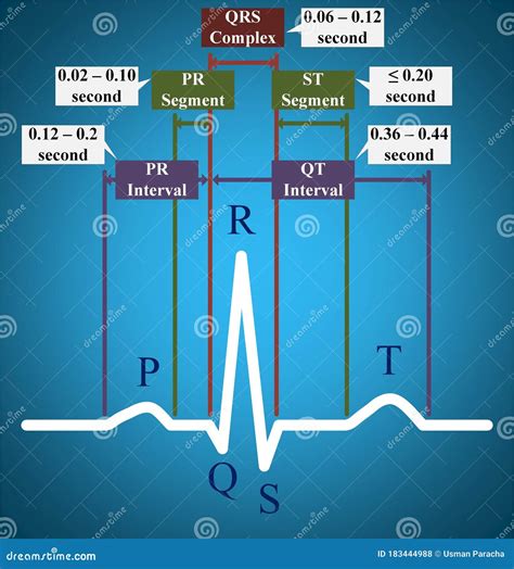 ECG or Electrocardiogram Showing Normal Time Duration Stock Illustration - Illustration of ...