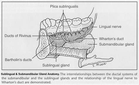 Sublingual Gland Removal – Exodontia