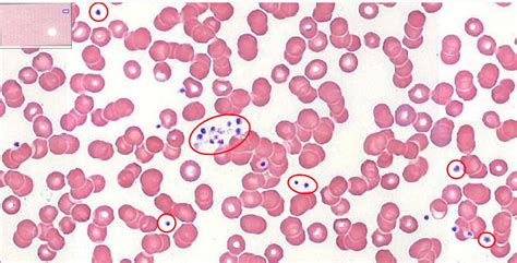 Blood and Bone Marrow | histology