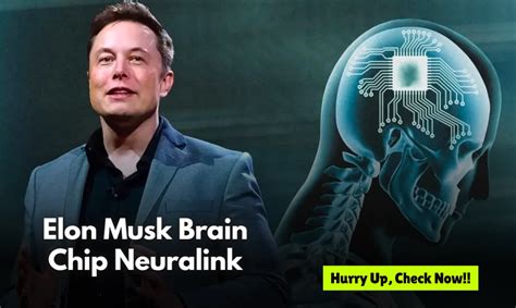 Elon Musk Brain Chip Neuralink: Check Complete Information » Online Prosess