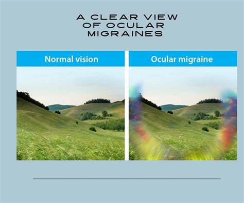 What Is an Ocular Migraine? | Florida Eye Microsurgical Institute