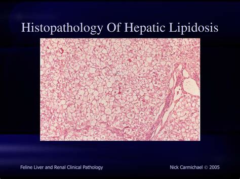 Hepatic Lipidosis Histology