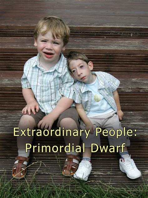 Prime Video: Extraordinary People: Primordial Dwarf