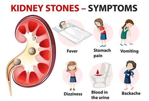 Renal Kidney Stone Treatment: Symptoms and Causes | Dr. Irfan Shaikh ...