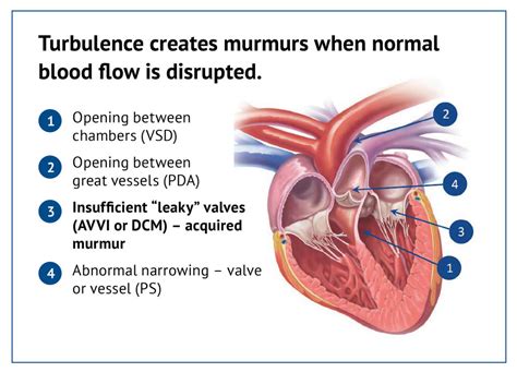 How To Tell If Heart Murmur - BEST HOME DESIGN IDEAS