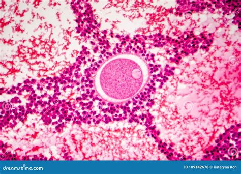 Light Micrograph of Human Ovary Stock Photo - Image of primordial ...