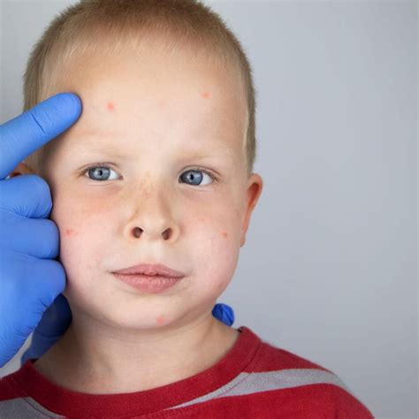 Pediatric Dermatology: 10 Common Skin Conditions in Children