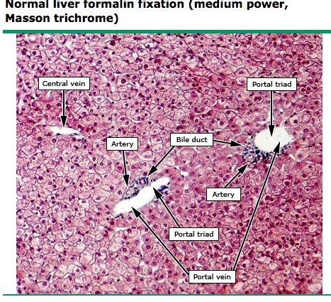 Liver Histology Labeled | www.imgarcade.com - Online Image Arcade! | Vet medicine, Bile duct ...