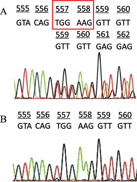 Mutational analysis of the c-kit gene using histological specimens. a ...