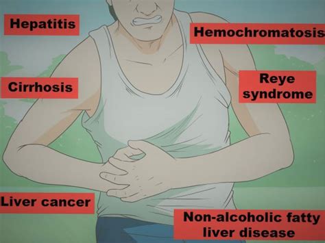 Liver Pain Location Diagram