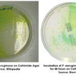 Cetrimide Agar Archives - universe84a