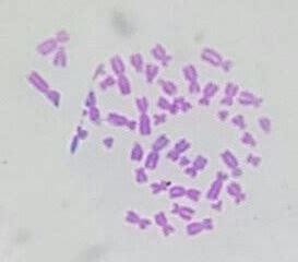 File:Human Chromosomes (crop).jpg - Wikimedia Commons