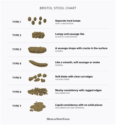 Bristol Stool scale: Stool types and what they mean