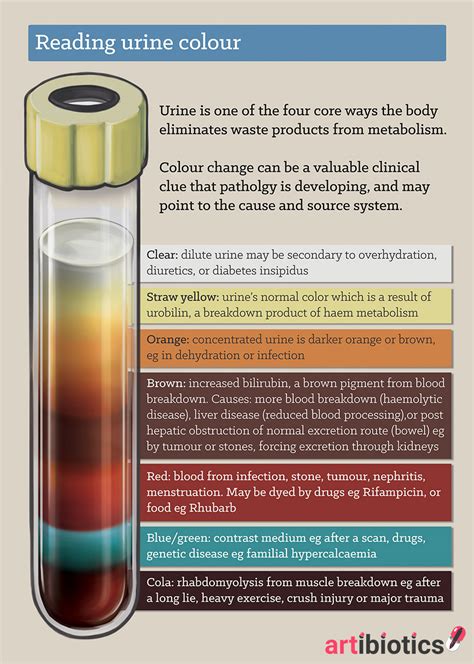 How to 'read' urine colour — artibiotics