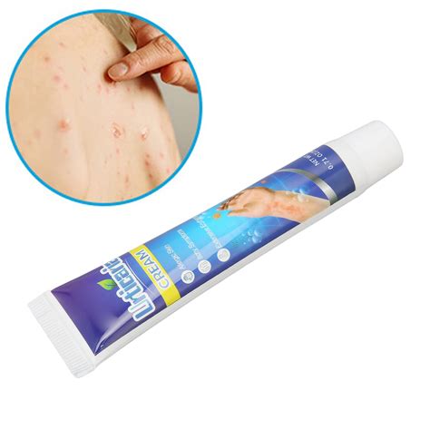 Itching Cream Pruritus Ointment for Dry Skin Adjunctive Treatment ...