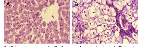 Feline Hepatic Lipidosis