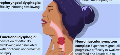 Dysphagia – causes, symptoms, diagnosis and treatment [EXPLAINED] – Healthy Food Near Me