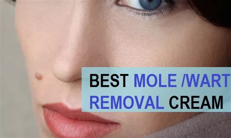 Top 9 Best Mole Removal Creams in India with Prices