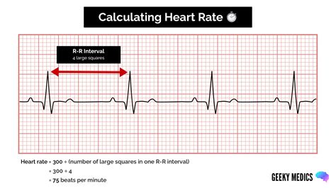 How To Learn Ecg - Economicsprogress5