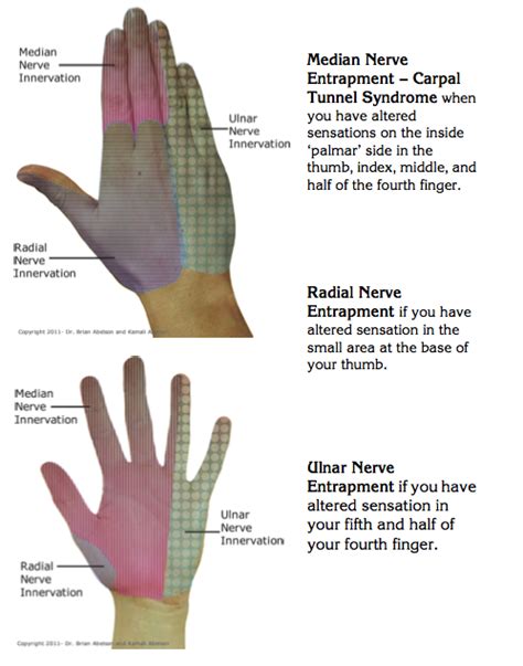 Radial Nerve: Flossing Radial Nerve