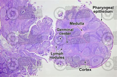 Man. Adenoid. Transverse section. 7X - Man - Mammals - Lymphatic system ...