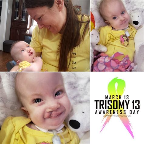 Annelise's Great Adventure: Life with Trisomy 18: 3/13 - Trisomy 13 Awareness Day