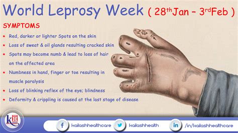 World Leprosy Week – Early diagnosis & treatment can prevent disability from Leprosy