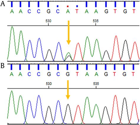 The Sanger sequencing electropherograms. Proband with heterozygous ...