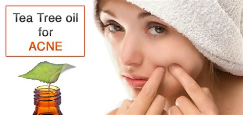 Amazing Benefits of Tea Tree Oil for Acne and Its 5 Uses