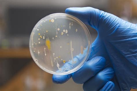 Inoculating Bacteria on Agar Plates by Streak-plating - Advancells Group