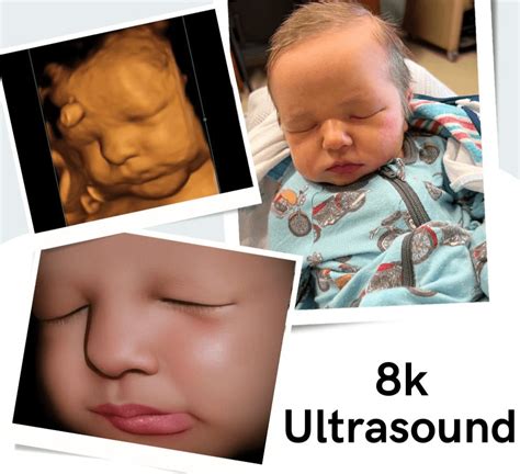 8K Ultrasound - Moss Bluff Prenatal Imaging - #1 3D & 4D Ultrasound in Lake Charles, LA