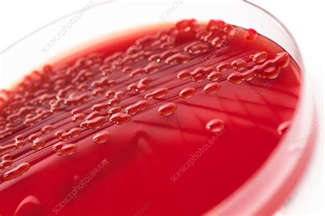 Serratia marcescens culture - Stock Image - C036/9185 - Science Photo ...