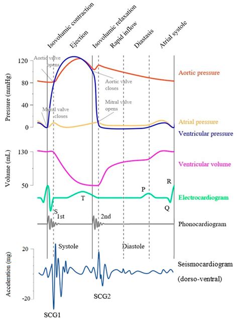 Wiggers Diagram Cardiac Cycle