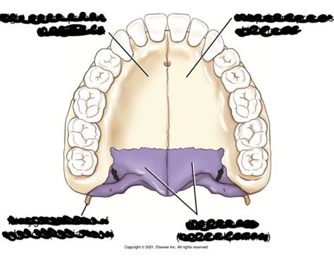 Maxilla bone anatomy — Printable Worksheet