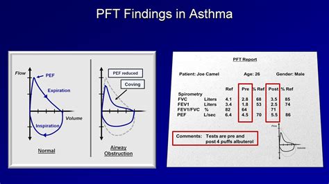 Differentiate Copd And Asthma - Asthma / They can have similar symptoms ...