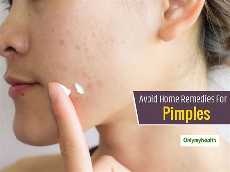 Avoid Any Random Home Remedy For Acne and Pimples, Seek These Professional Treatment Instead ...