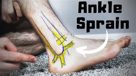 Tendons In Ankle - The Complete Anatomy & Injury Guide!