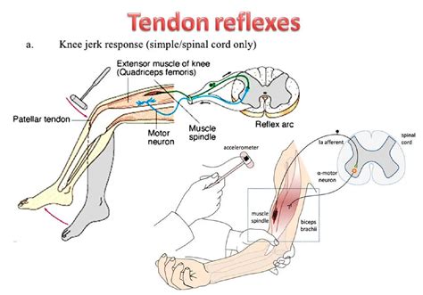 Brachial Reflex