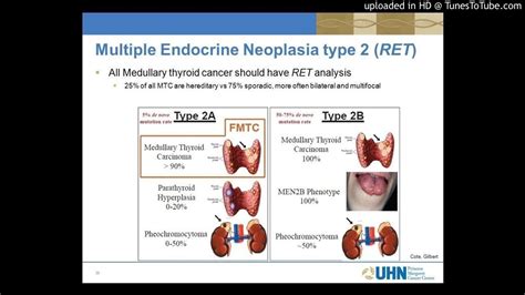 Multiple Endocrine Neoplasia Types Causes Symptoms Diagnosis | Hot Sex Picture