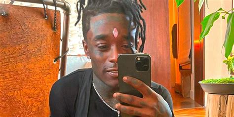 Lil Uzi Vert Removes $24M USD Forehead Diamond | Hypebeast