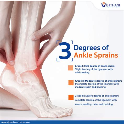 What Is Ankle Sprain