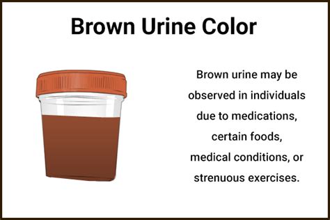 What Does It Mean When Your Urine Is Really Dark Brown - Infoupdate.org