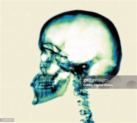 Human Head Anatomy Profile Photos and Premium High Res Pictures - Getty Images