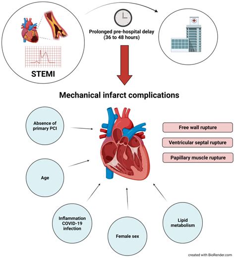 Mechanical complications after STEMI: Another collateral damage of the COVID-19 pandemic ...